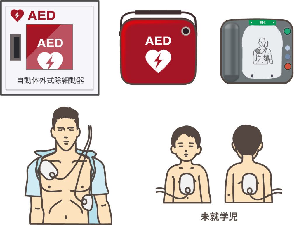 AEDの使い方：パッド貼り付け位置
